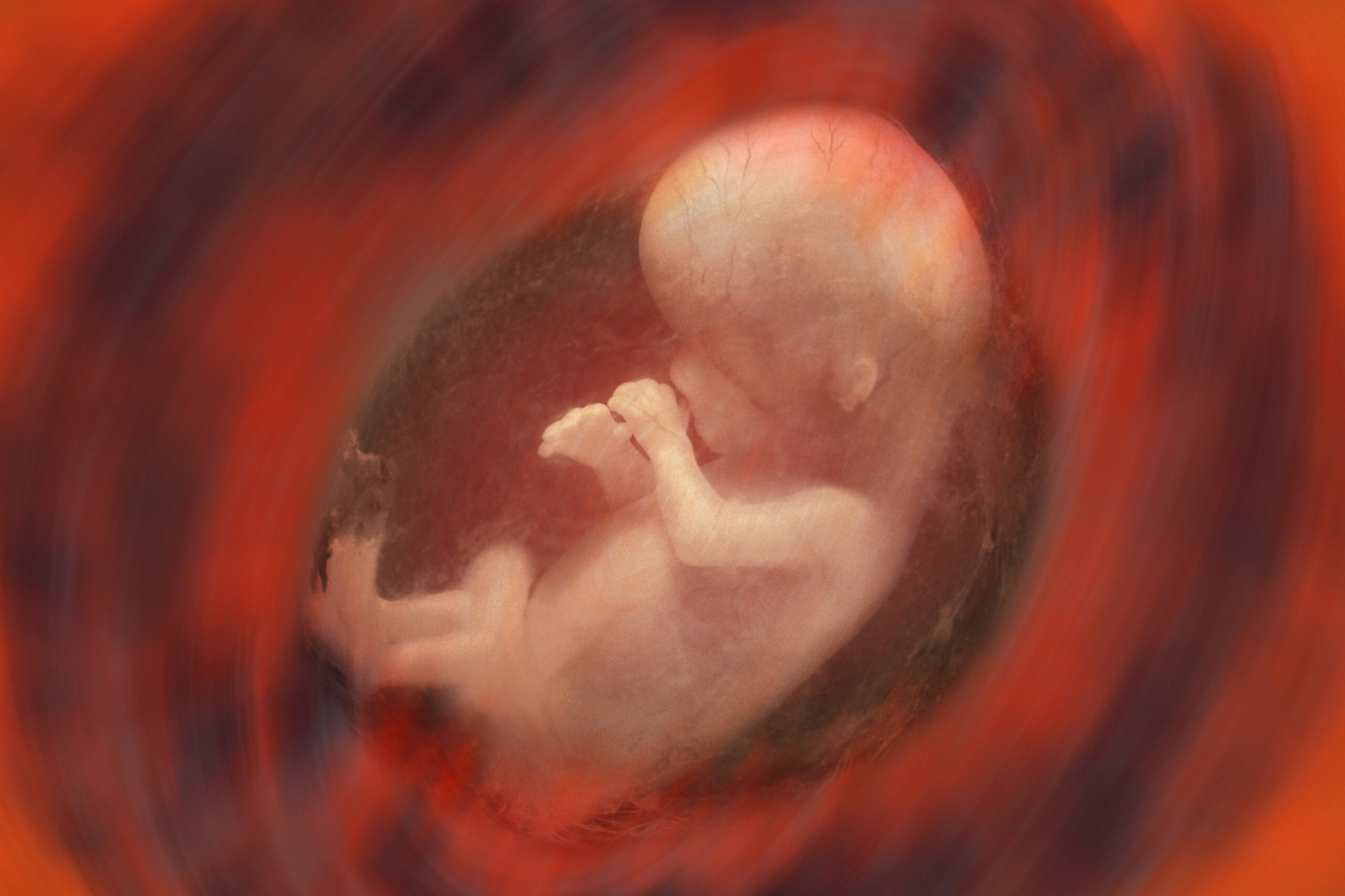 Плод становится человеком. 10 Недель беременности фото плода. Эмбрион на 10 неделе беременности. Зародыш человека 13 недель.