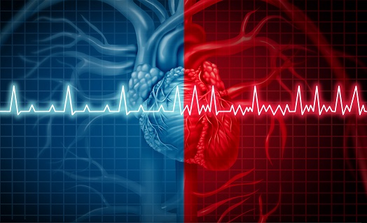 Wat verstaan we onder een hartaandoening?