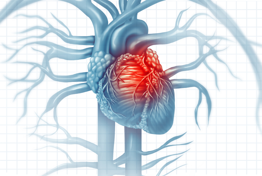 Meer te weten komen over hartinfarct symptomen mannen